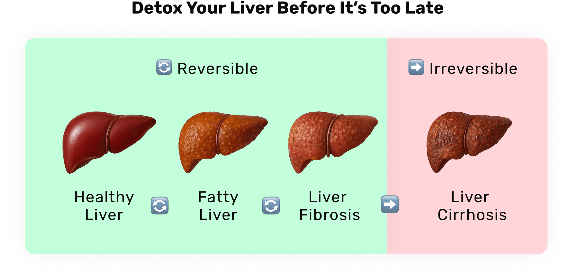 files/Detox_Your_Liver_Before_It_s_Too_Late.png